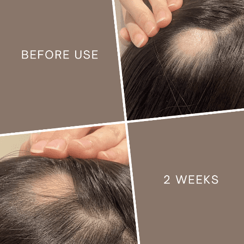 La Verne Lumiere 5α-Avocuta T Strengthening Hair Care Set