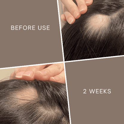 La Verne Lumiere 5α-Avocuta T Strengthening Hair Care Set